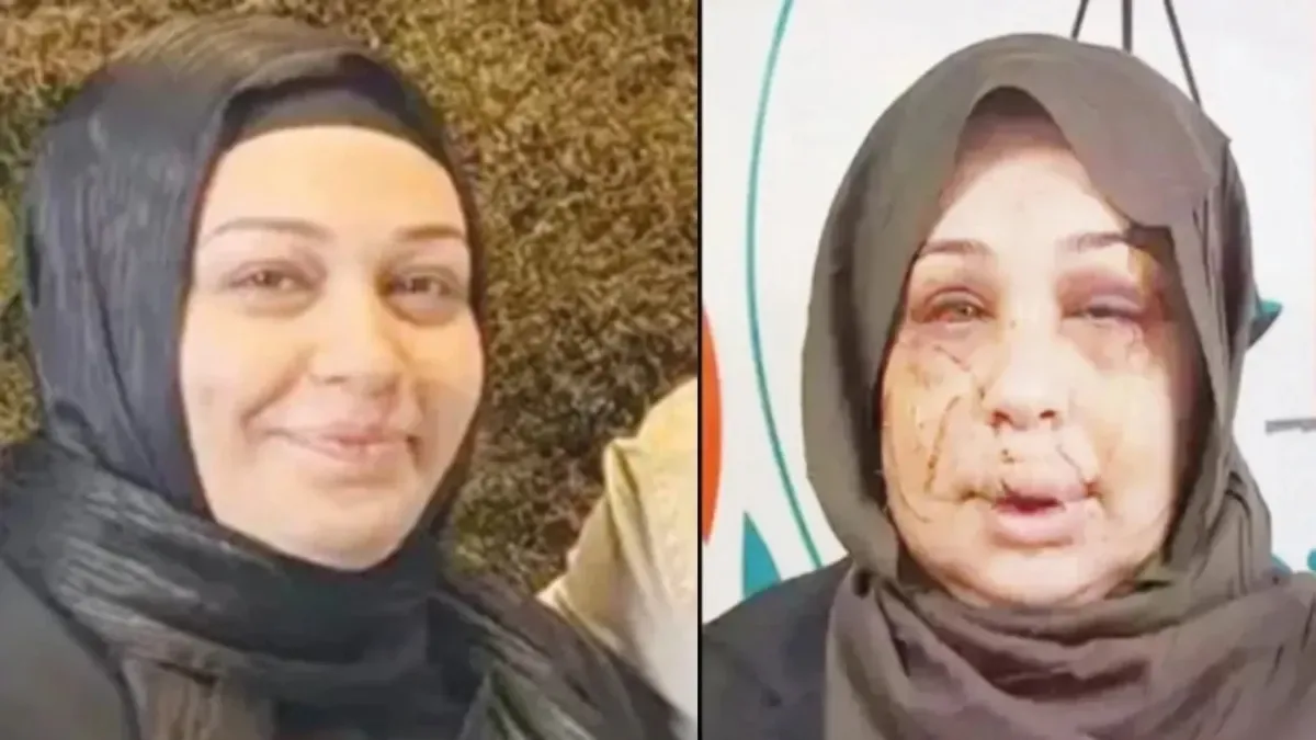 Ankara’da Şiddet İddiası: Eşler Hapis Cezası Aldı