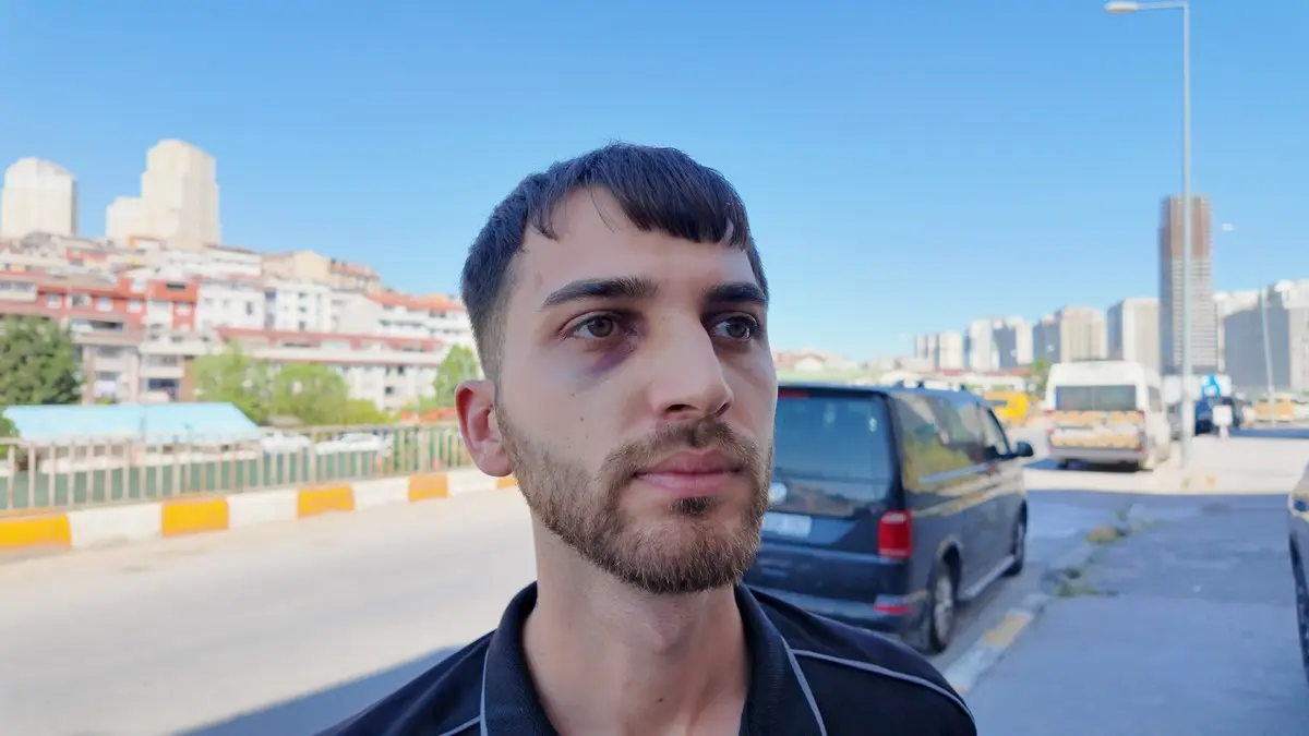 Tutanak tutmak istedi darp edildi! Korkunç anlar kamerada:
