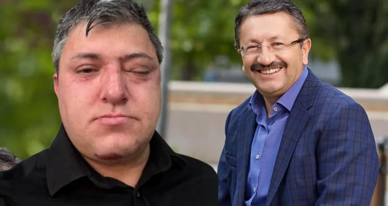 Belediye Binasında Şok: Başkan Darp Etti!