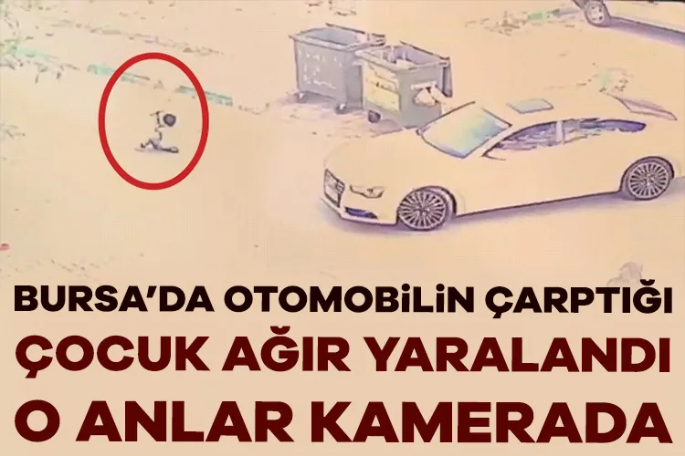 Bursa’da Otomobil Çocuğa Çarptı, Ağır Yaralı!