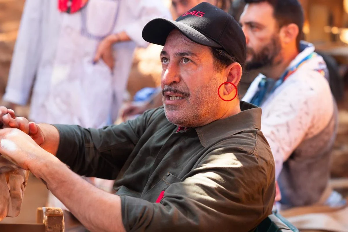 Cem Yılmaz’ın Kalp Krizi Sonrası Kulak Memesindeki Detaylar Dikkat Çekti