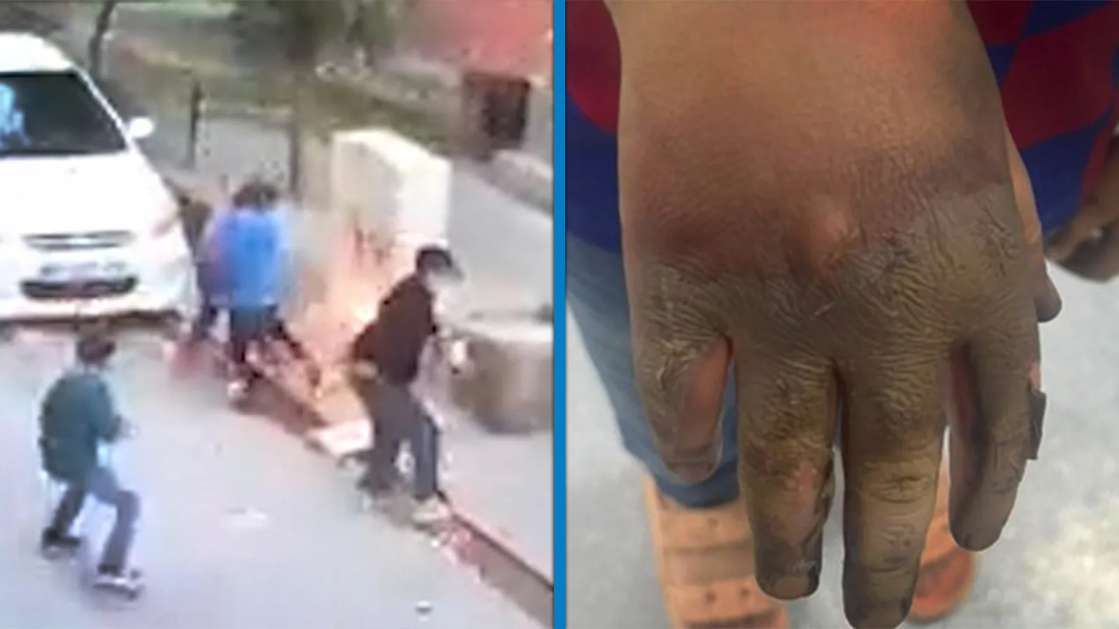 Çocuk Elektrik Panosuna Temas Etti, Yaralandı!