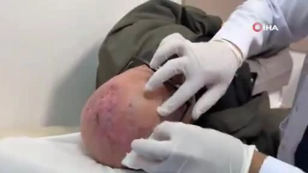 Dünyada sadece iki örneği vardı, üçüncüsü Türkiye'de çıktı! Ceviz büyüklüğünde...