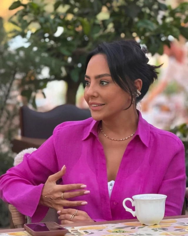 Ebru Gündeş, 10 Milyon TL’lik Estetik Operasyon Sonrası Yeni Görünümüyle Gündemde