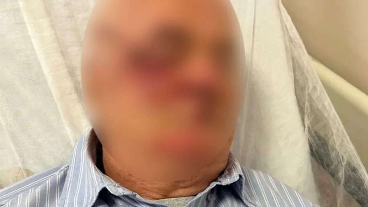 Emekli Başkomiser Çocuğu Uyardı, Kavga Büyüdü!