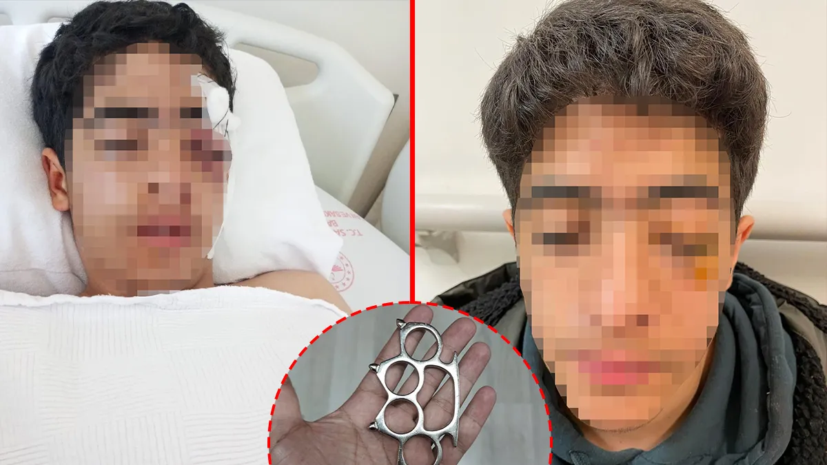 Esenyurt’ta Akran Zorbalarına Ağır Saldırı!