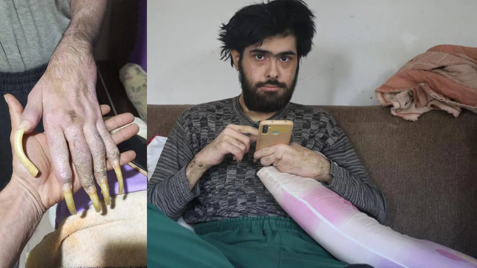 Genç, 3 Yıldır Evden Çıkmadan Yaşıyor!