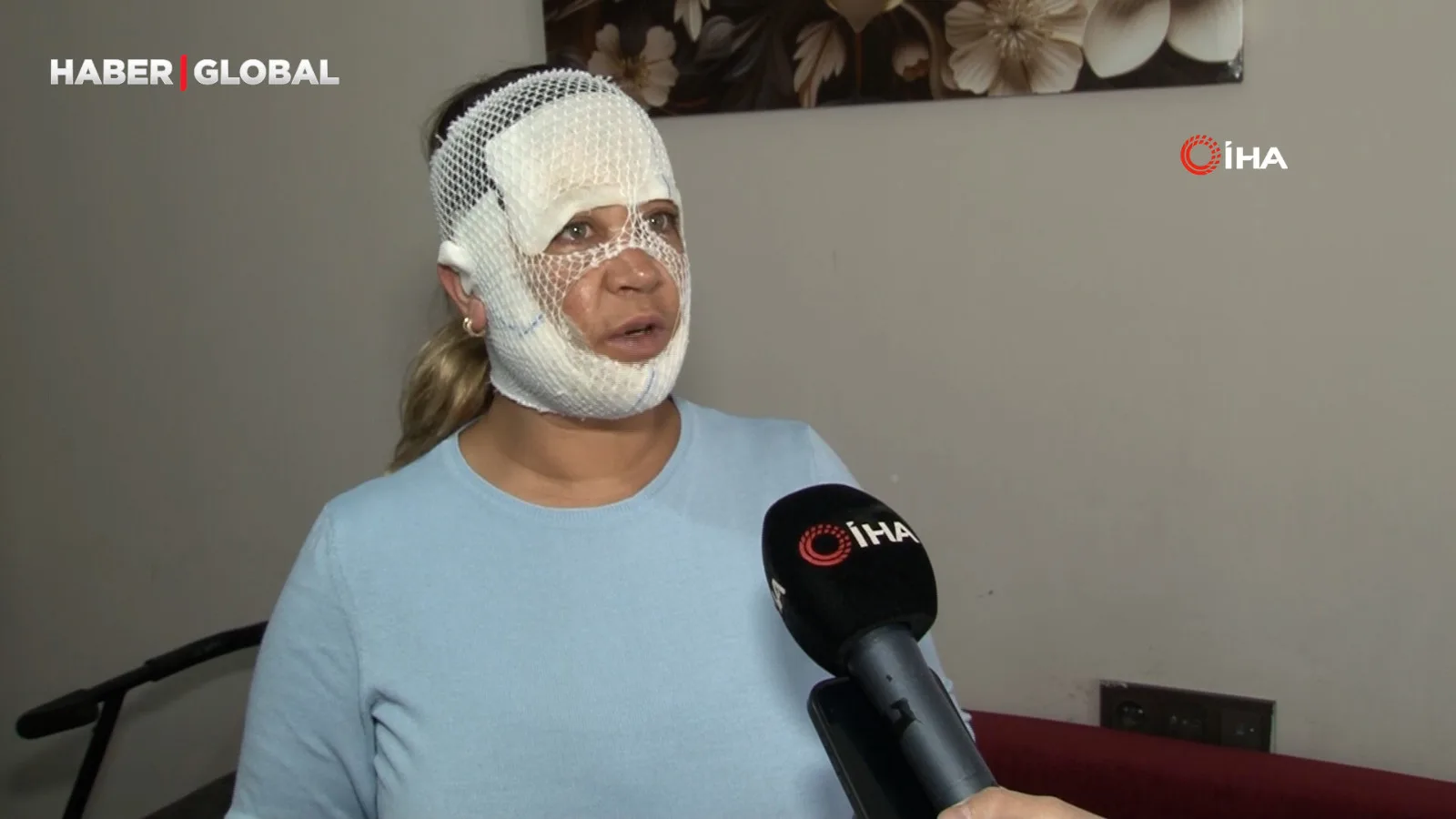Güzelleşmek İsterken Yüzü Yandı, Oğluna Korku Verdi!