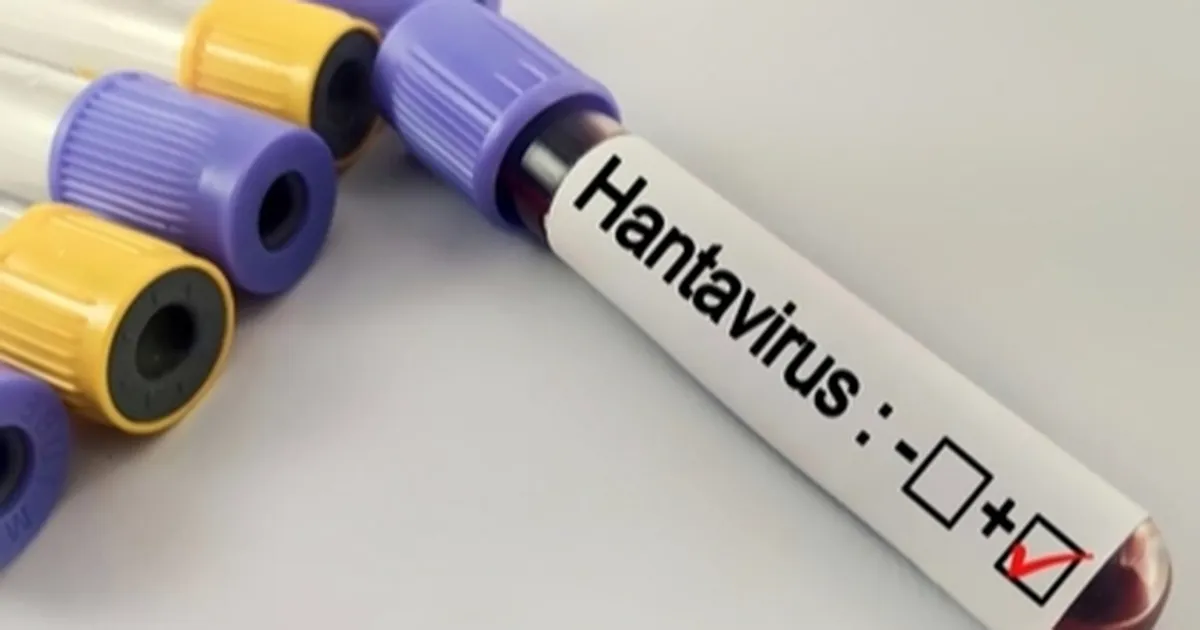 Hantavirüs Uyarısı: Riskli Alanlarda Dikkat!