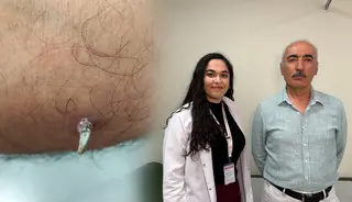 1 santimlik yara için gitti, kanser olduğunu öğrendi!