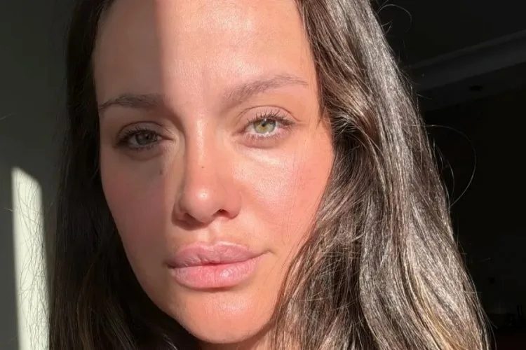 İrem Helvacıoğlu Kaza Geçirdi: Sağlık Durumu İyi