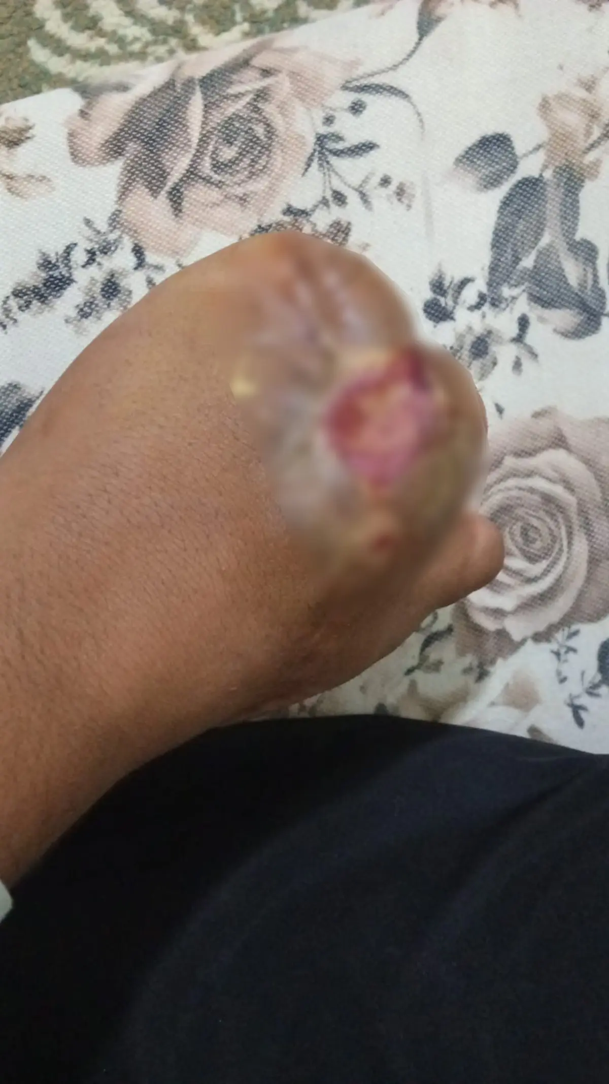 Elini makineye kaptırdı: Parmak başı 100 bin teklif ettiler!