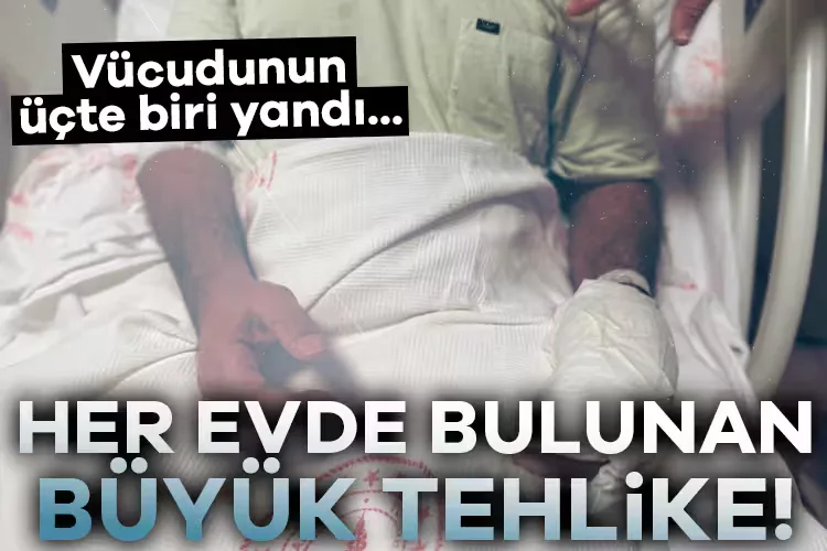 Isı Kaynağıyla Gelen Korkunç Yanık!