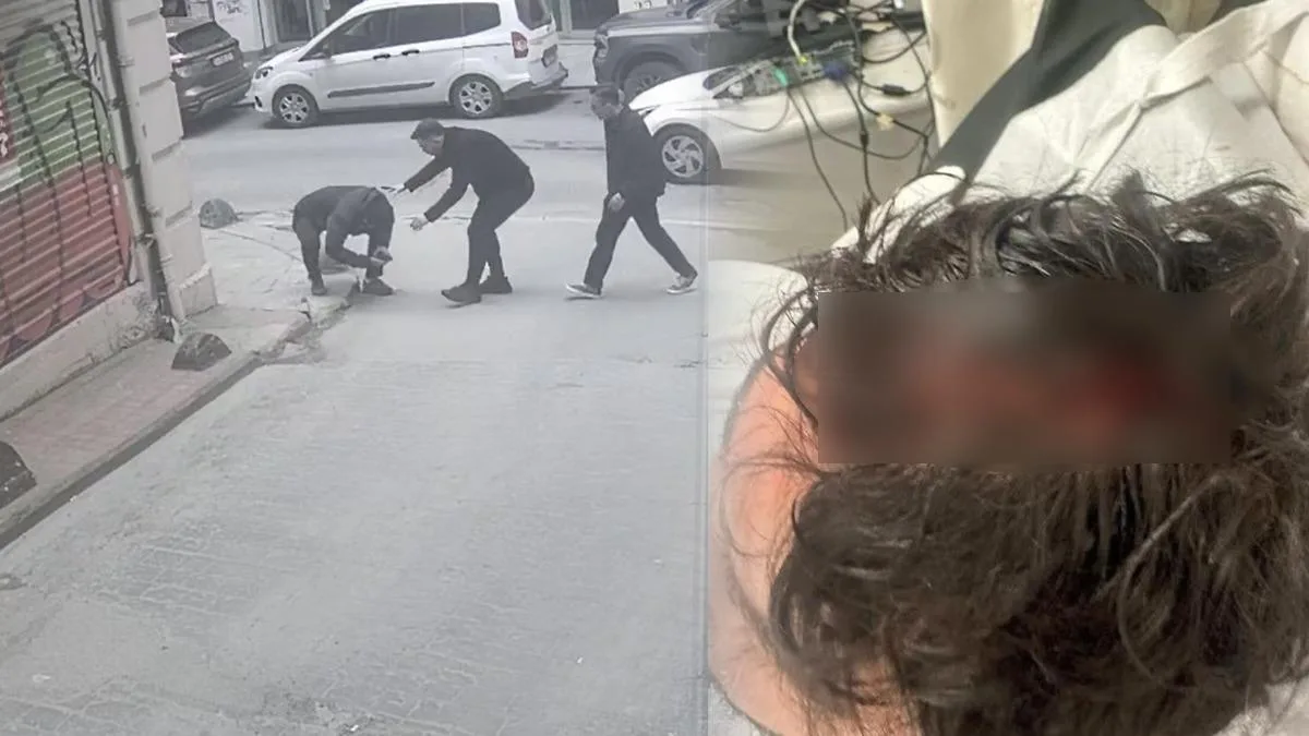 İstanbul’da Cam Parçası İle Ölümden Dönüş!