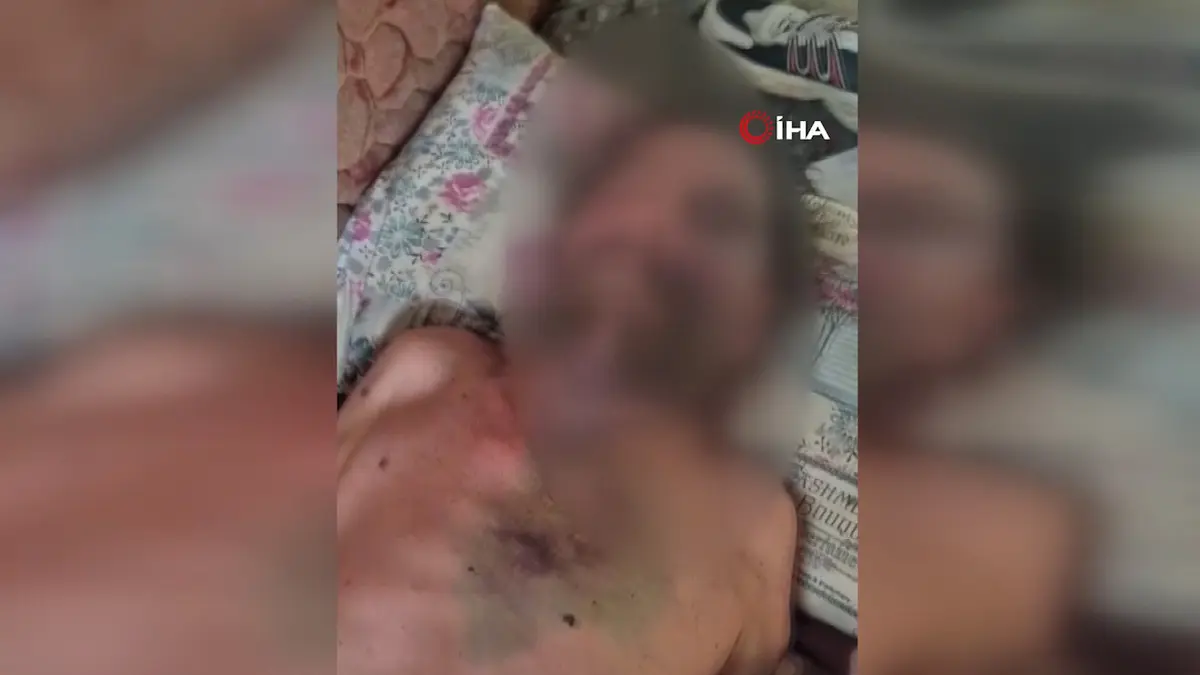 Böylesi görülmedi: Abimin cenazesine neden gelmedin denilerek öldüresiye darp edilmiş halde metruk binada bulundu 3