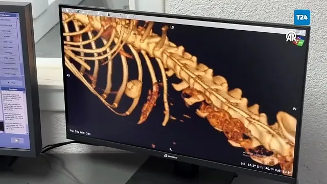 Kedinin Midesinden Vakumlu Tutucu Çıkarıldı