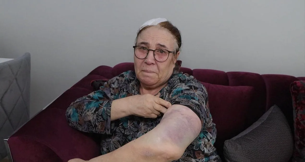 Komşu Kavgasında Sopa ve Dikiş Gerçeği!