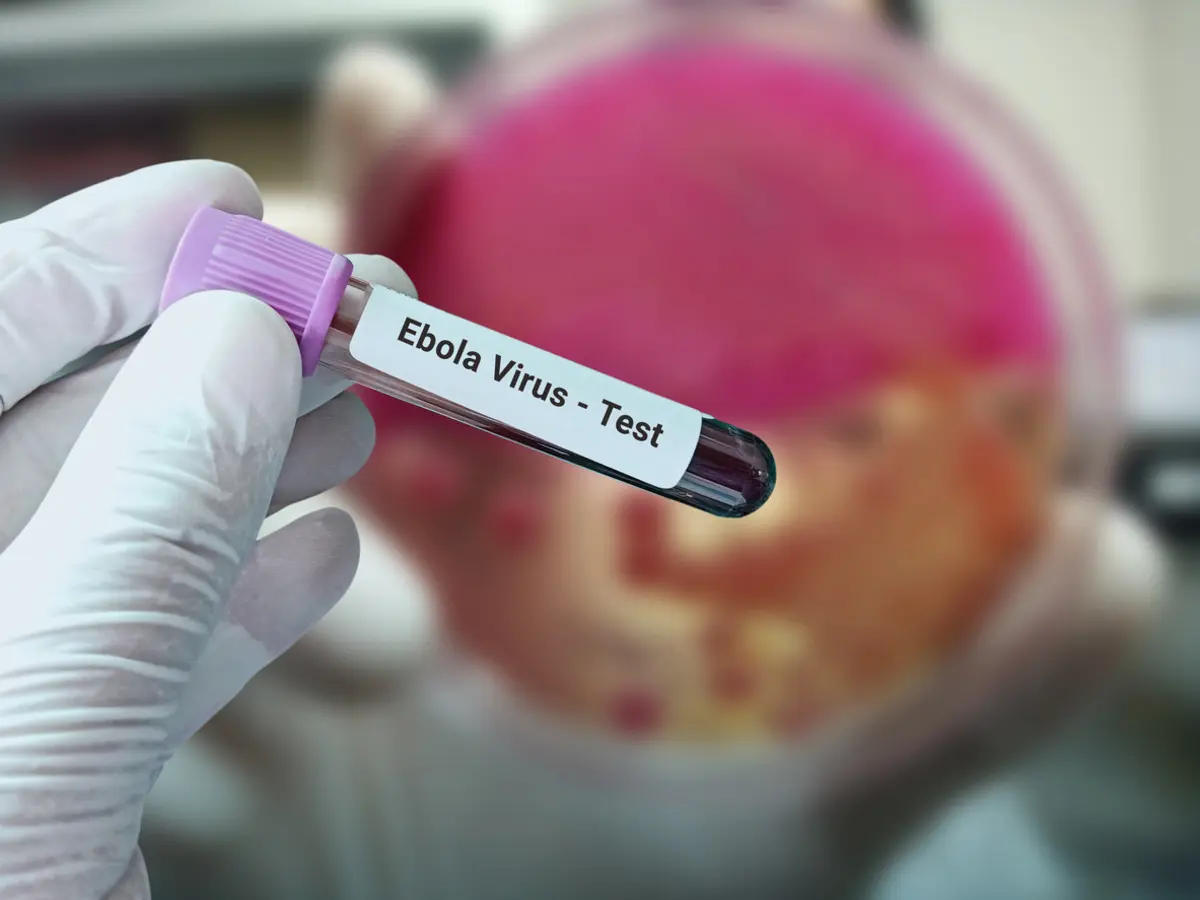 Afrika da Ebola kabusu geri döndü! Ölü sayısı 4 bini geçti: Ne aşısı var ne tedavisi 1