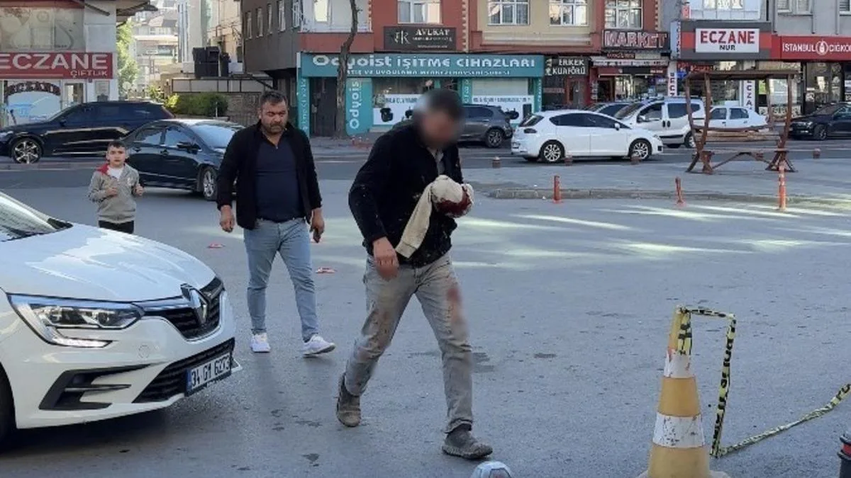 Kurban Bayramı’nda Acemi Kasaplar Hastanelik Oldu!