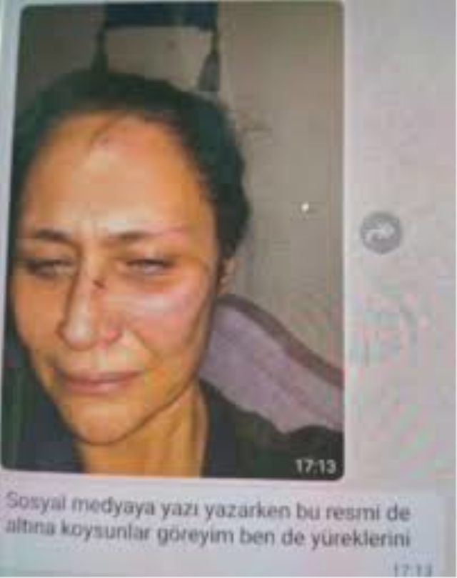 Levent İnanır’dan Neslihan Acar’ın Şiddet İddiasına Yanıt ve Miras Tartışmaları