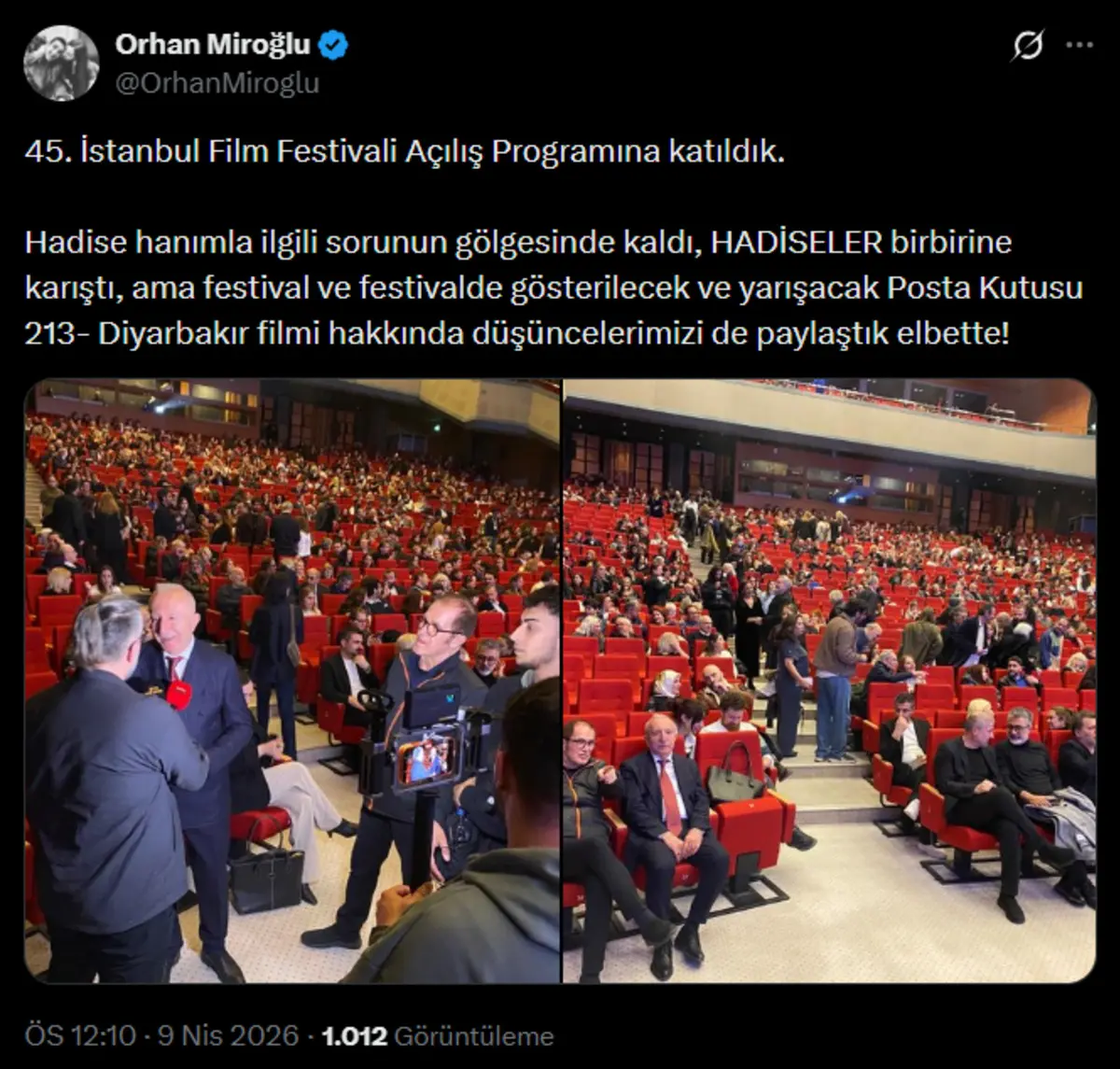 AK Partili Miroğlu'ndan şarkıcı Hadise sorusuna beklenmedik yanıt: Kafalar karıştı 2