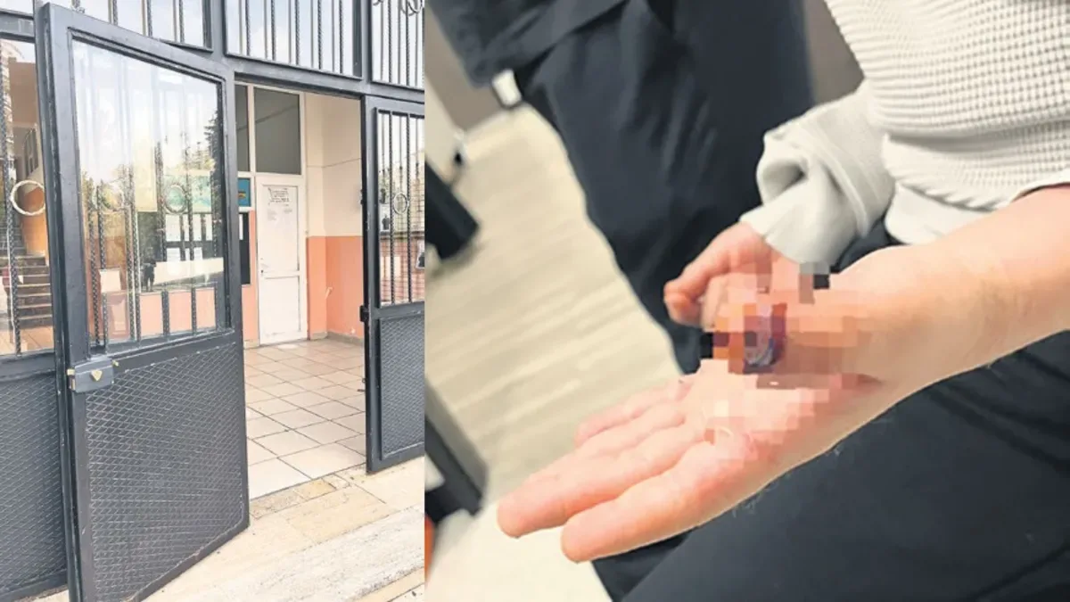 Okulda Korkunç Kaza: 7 Yaşındaki Çocuğun Parmağı Koptu
