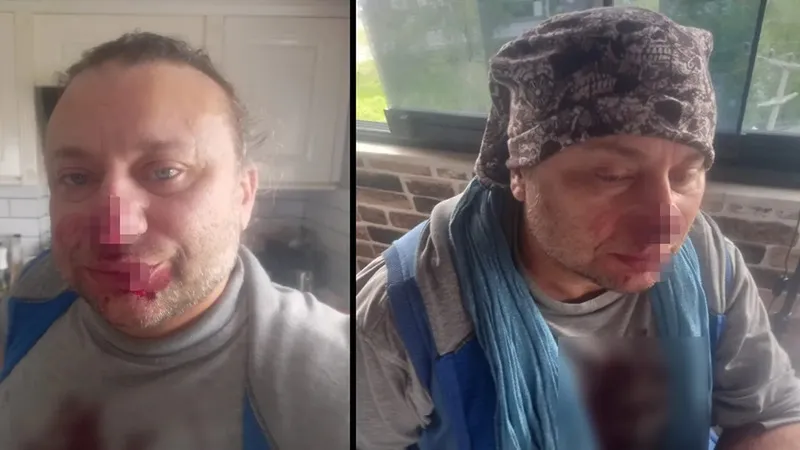 Onur Akay’ın Sağlık Durumu Ciddi: Nekrotizan Fasiit