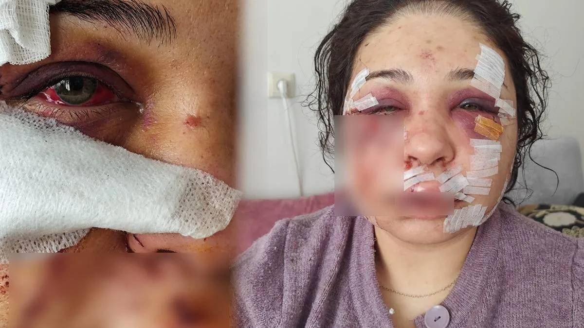 Polis Eşine Şiddet: Kadına Hapis Cezası!