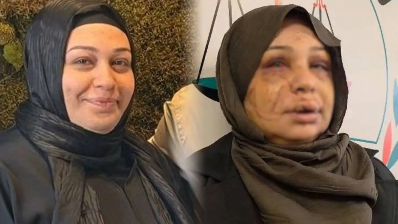 Polis Memuruna Ağır Ceza: Kadına Şiddet Davası