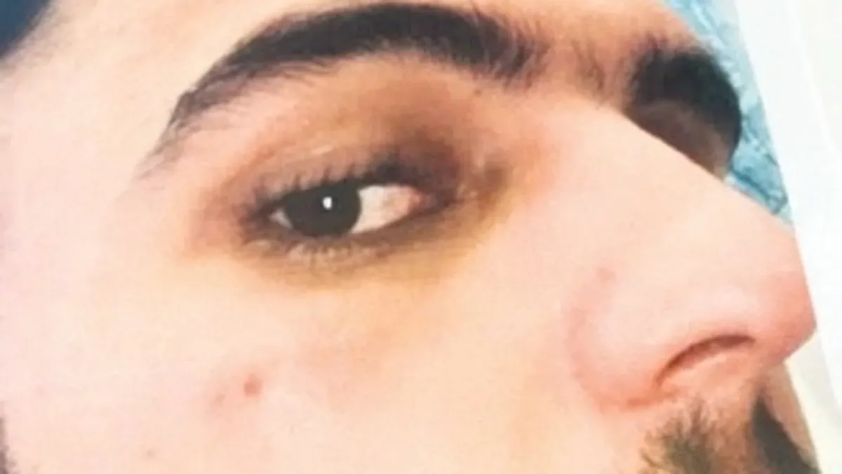 Silahlı Saldırıya 10 Yıl Hapis İstemi!