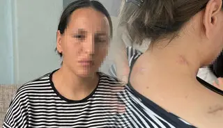 Eşini, çocuğunun gözü önünde 17 kez bıçakladı! Ölü numarası yaparak kurtuldu