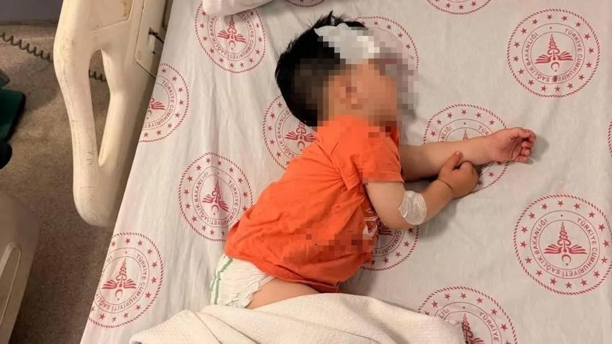 Sokak Köpeği Saldırısı: Küçük Çocuk Yaralandı