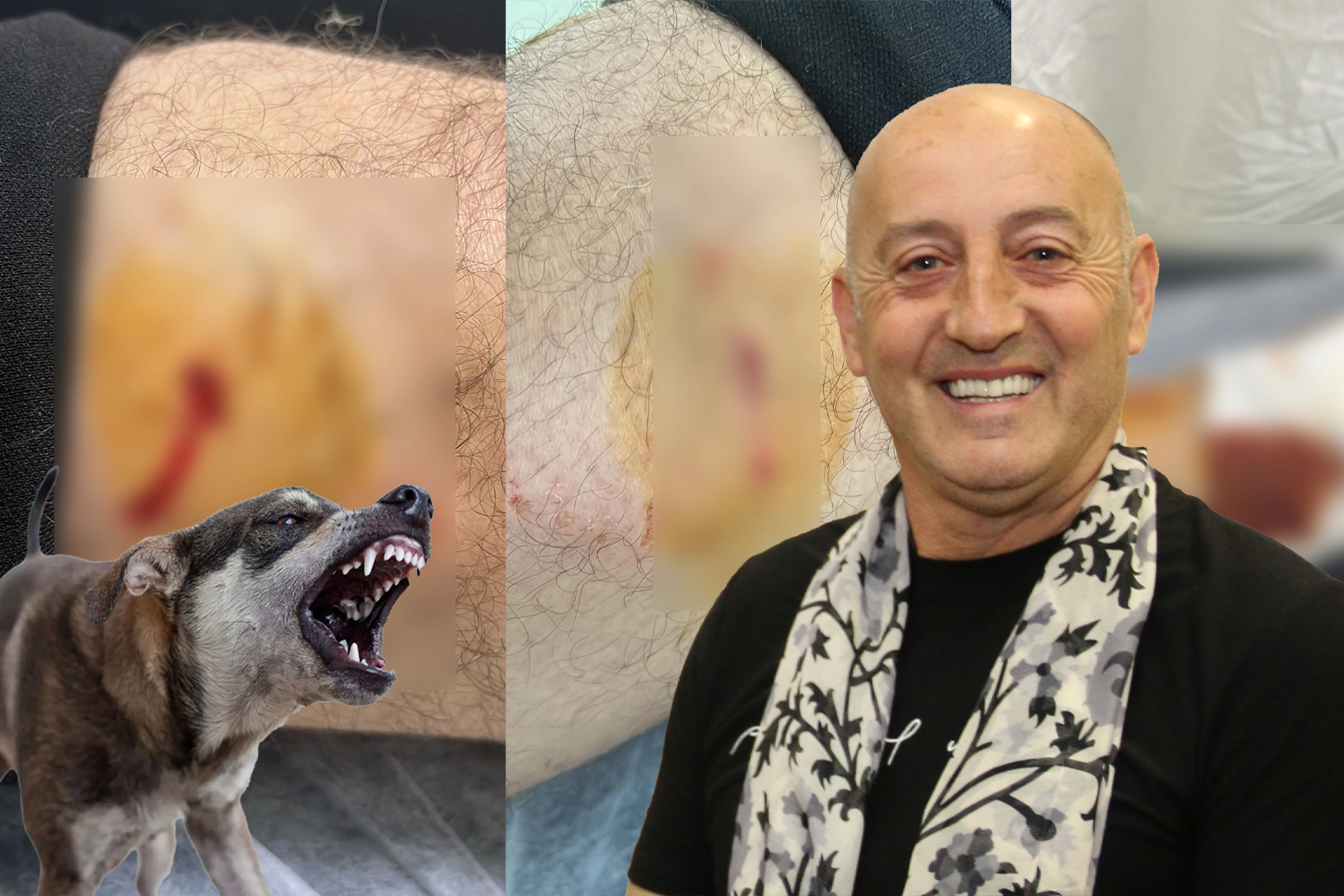 Sokak Köpekleri Mahalle Muhtarına Saldırdı!
