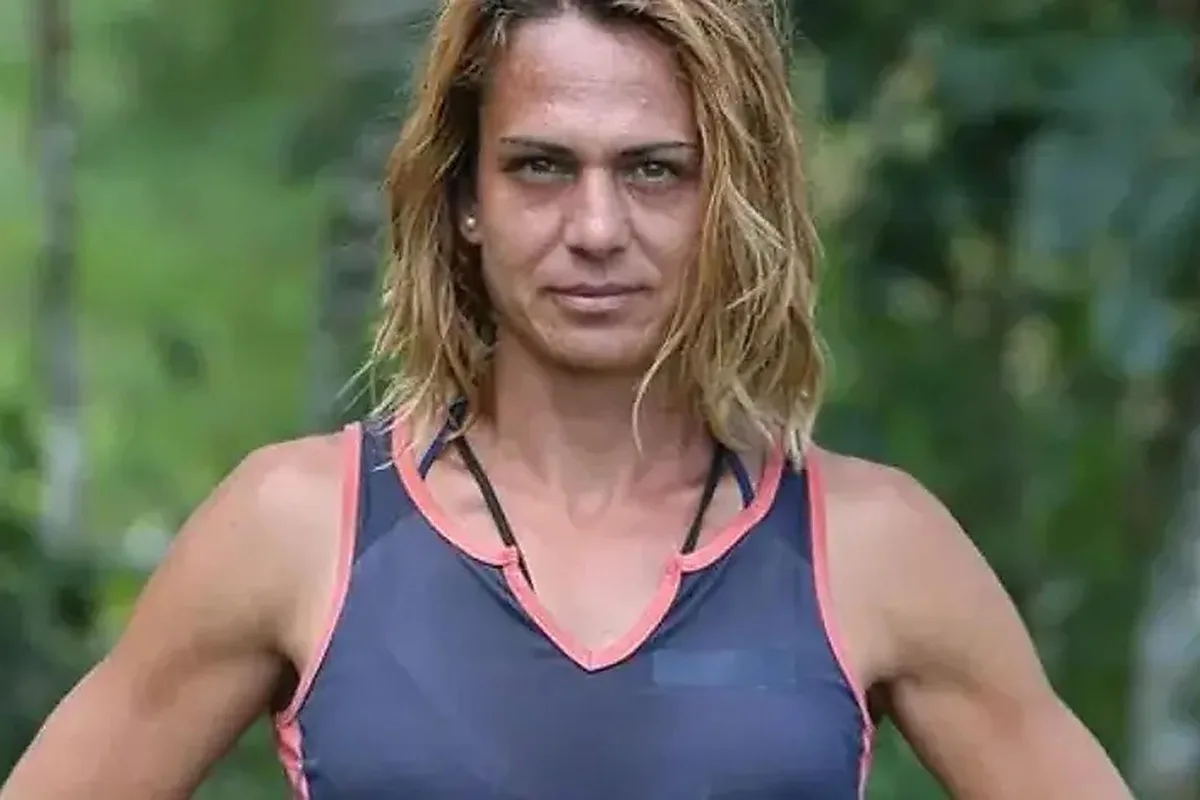 Survivor Nagihan Karadere, Estetik Operasyonunun Ardından Son Haliyle Gündemde