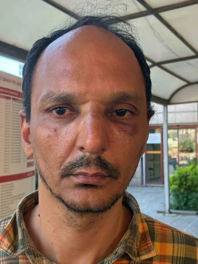 TOMA’nın üstüne çıktığı görüntü gündem olmuştu! Tutuklandı; dikkat çeken detay ortaya çıktı 2
