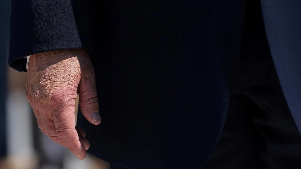 Trump’ın Makyajlı Eli Gündem Oldu!