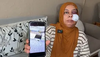 Elektrikli bisikletle rögara düştü! Tanınmayacak hale geldi