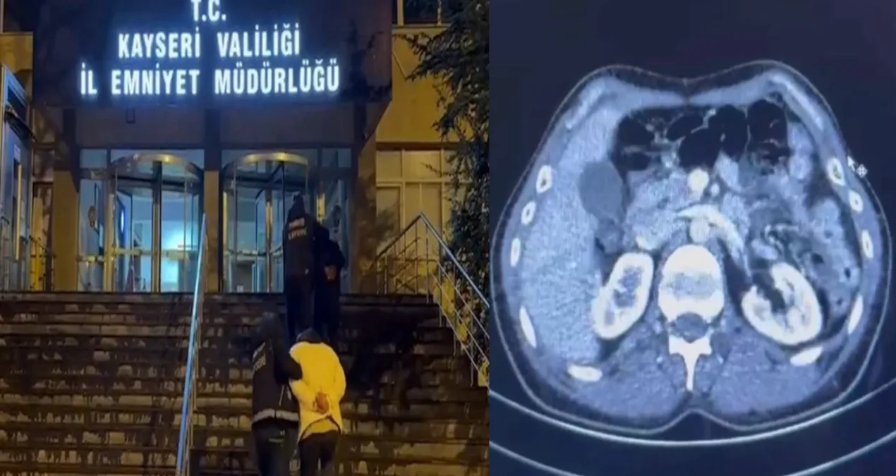 Uyuşturucu Kuryeleri Hastaneye Sevk Edildi!